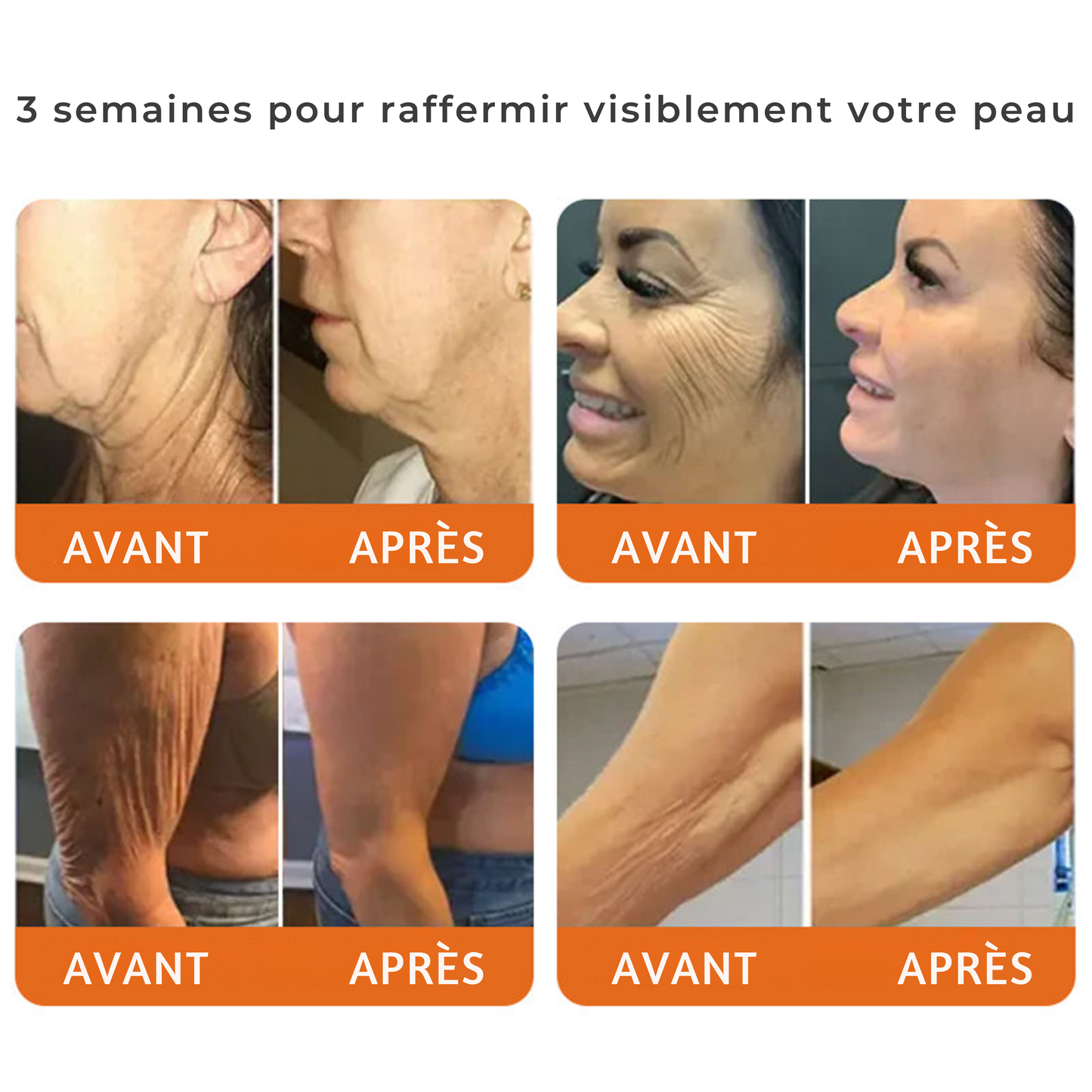 Crème intégrale au venin d'abeille
