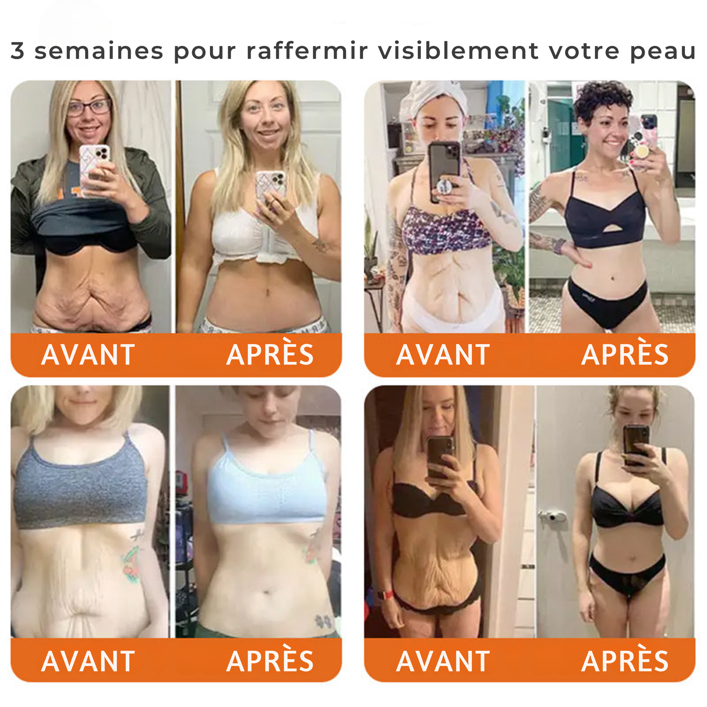 Crème intégrale au venin d'abeille