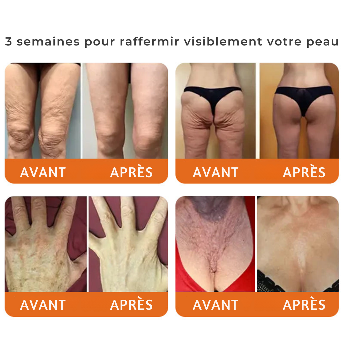 Crème intégrale au venin d'abeille