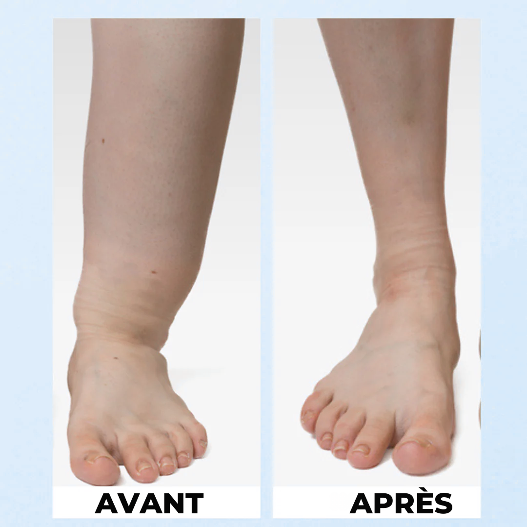 Libérez vos jambes des gonflements en 15 min